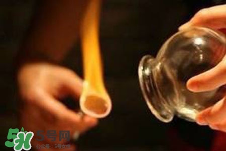拔罐放血能治皮膚病嗎？拔罐放血能治牛皮癬嗎？