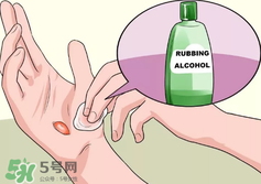 水泡怎么處理？水泡要不要刺破？