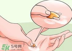 水泡怎么處理？水泡要不要刺破？