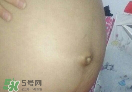 產后肚臍眼臭是怎么回事?產后肚臍眼臭怎么辦?