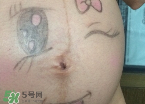 產后肚臍眼臭是怎么回事?產后肚臍眼臭怎么辦?