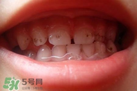 刷牙后吃東西發(fā)苦正常嗎？為什么刷牙后吃東西發(fā)苦？