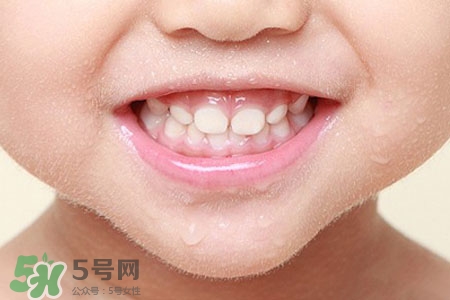 刷牙后吃東西發(fā)苦正常嗎？為什么刷牙后吃東西發(fā)苦？
