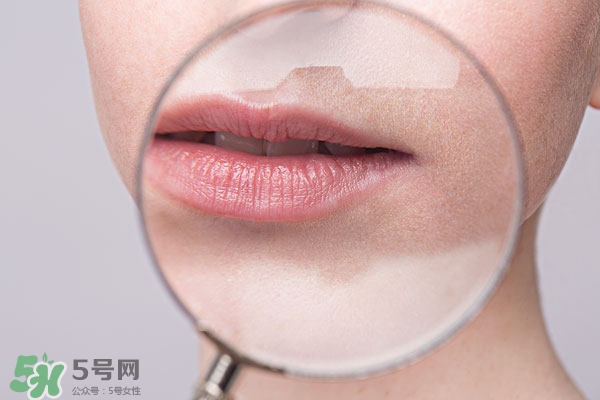 嘴唇起泡腫了怎么辦？嘴唇起泡腫了怎么消腫