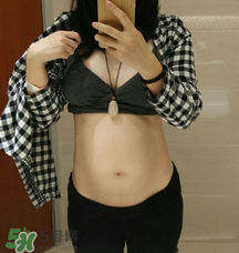 預(yù)防妊娠紋用什么好？懷孕期間如何預(yù)防妊娠紋