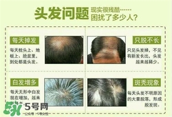 牛角梳梳頭可以生發(fā)嗎？牛角梳怎么梳頭？