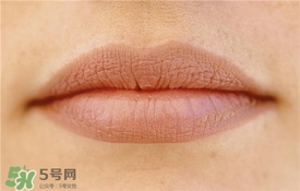 卡唇紋是什么意思？卡唇紋怎么辦？