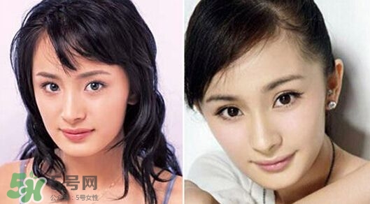 打瘦臉針能懷孕嗎？打瘦臉針能吃避孕藥嗎？