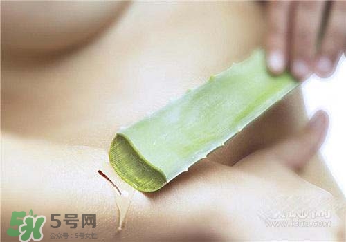蘆薈涂在臉上發(fā)癢是怎么回事？蘆薈涂在臉上發(fā)癢怎么辦？