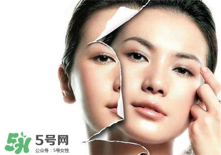美白針是什么？美白針可以連續(xù)打嗎？