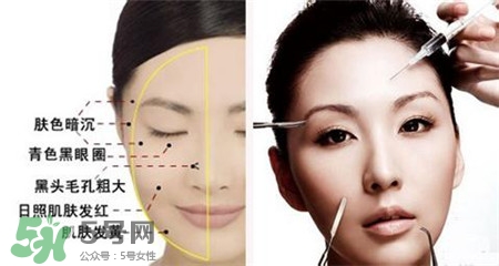 美白針的效果明顯嗎？美白針一個(gè)療程幾次？