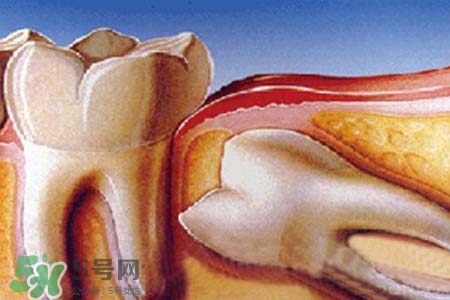 智齒會(huì)一直長(zhǎng)嗎？智齒會(huì)停止生長(zhǎng)嗎？