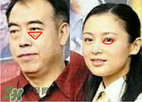臥蠶是黑眼圈嗎？臥蠶和黑眼圈的區(qū)別