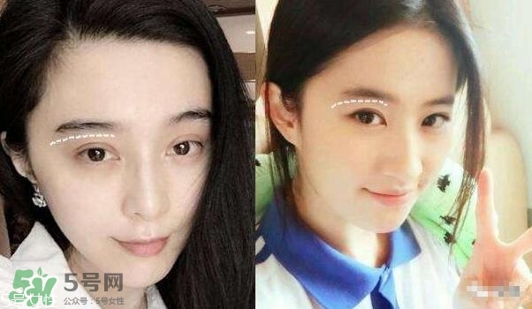 割雙眼皮有幾種做法？雙眼皮有哪幾種形狀？