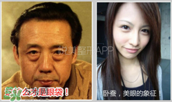 臥蠶是黑眼圈嗎？臥蠶和黑眼圈的區(qū)別