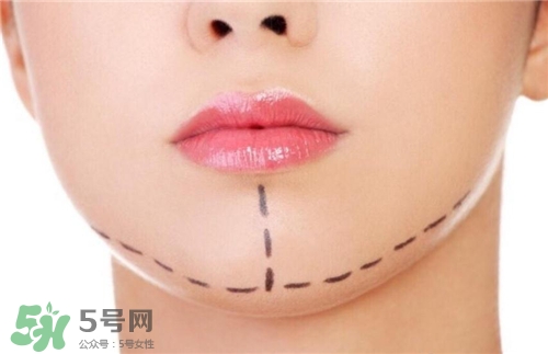 玻尿酸墊下巴能維持多久？玻尿酸墊下巴能維持多長時(shí)間？