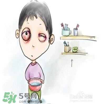 紅眼病是怎么引起的？紅眼病怎么產(chǎn)生的
