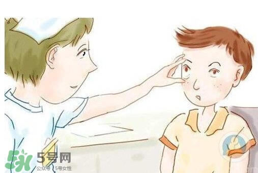 紅眼病用什么眼藥水好？紅眼病吃什么好得快