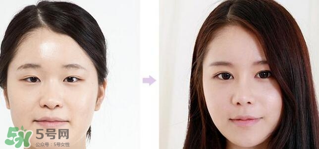 哪些人需要開眼角？需要開眼角的眼睛圖片