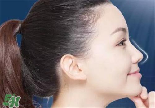 隆鼻會拉近眼距嗎？隆鼻會改變眼睛嗎？