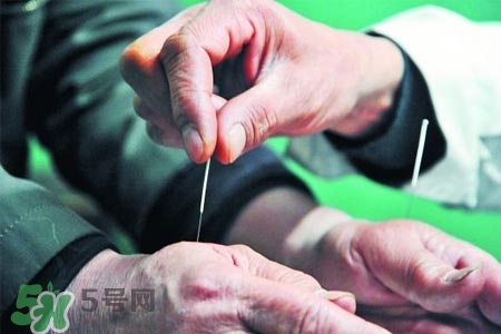 沒(méi)病可以針灸嗎？沒(méi)病可以扎針嗎？
