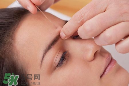 沒(méi)病可以針灸嗎？沒(méi)病可以扎針嗎？