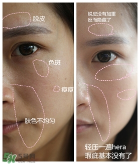 赫拉氣墊用了悶痘嗎？赫拉氣墊悶痘怎么辦？