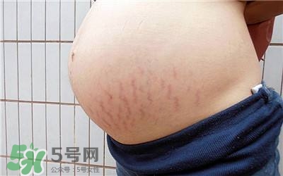 妊娠紋幾個(gè)月開(kāi)始出現(xiàn)？妊娠紋能消除掉嗎？