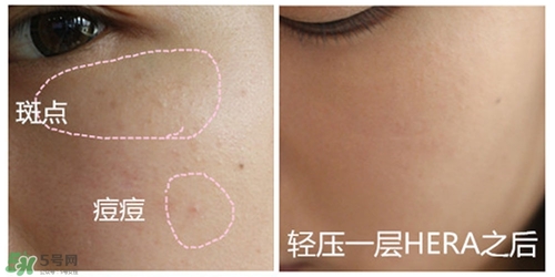 赫拉氣墊用了悶痘嗎？赫拉氣墊悶痘怎么辦？