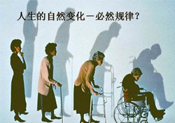 哪些人容易得骨質(zhì)疏松癥？骨質(zhì)疏松的高發(fā)人群有哪些？