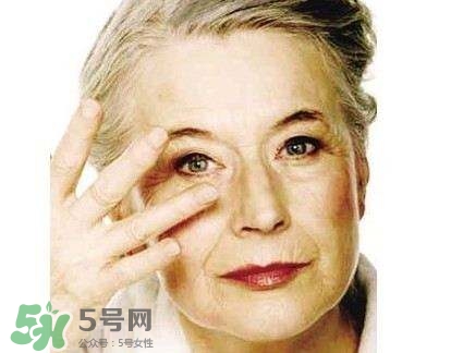 老年斑是怎么形成的？老年斑的形成原因