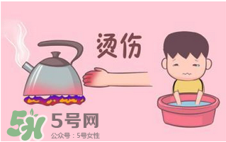 燙傷可以用牙膏嗎？燙傷用牙膏管用嗎？