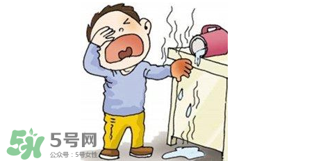 燙傷可以用牙膏嗎？燙傷用牙膏管用嗎？