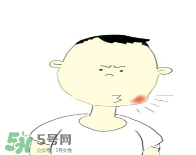 嘴角起泡是什么原因？嘴角起泡怎么辦？