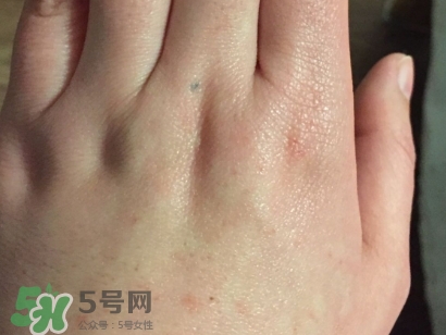薇諾娜適合什么皮膚？薇諾娜適合敏感肌嗎？