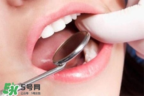 口腔異味是怎么回事？口腔異味怎么清除？