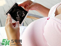 保胎期間可以洗澡嗎？臥床保胎可以洗澡嗎？