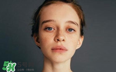 長(zhǎng)斑是什么原因引起的？祛斑效果最好的方法