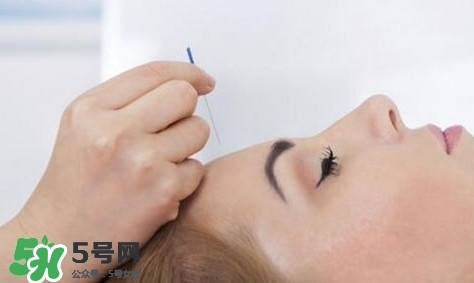 叢集性頭痛會死人嗎？叢集性頭痛的特點