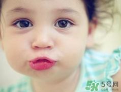 孕期可以激光祛斑嗎？懷孕了能做激光祛斑嗎？