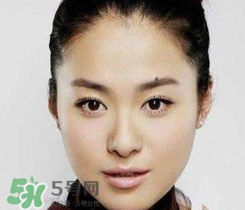 如何預防臉上長痣？怎樣預防臉上長痣