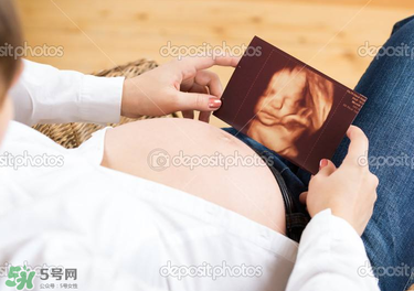 橄欖油真的可以預(yù)防妊娠紋嗎？橄欖油真的可以去妊娠紋嗎？