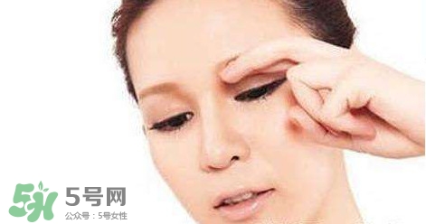 怎樣祛除眼底細(xì)紋？如何去除眼底細(xì)紋