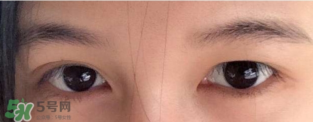 眼睛發(fā)黃是怎么回事？眼睛發(fā)黃是什么原因