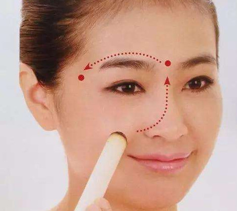 艾灸可以去黑眼圈嗎？艾灸可不可以去黑眼圈