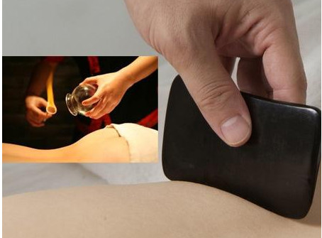 刮痧之后可以拔罐嗎？刮痧之后可不可以拔罐