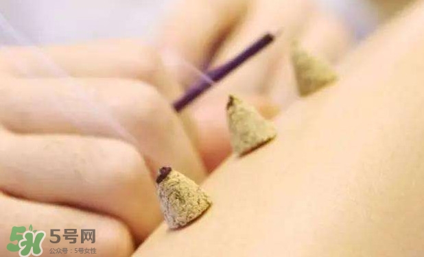 剛懷孕可以艾灸嗎？剛懷孕可以艾灸腹部嗎