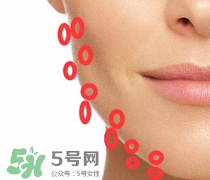 nuface美容儀有效嗎？nuface美容儀副作用？