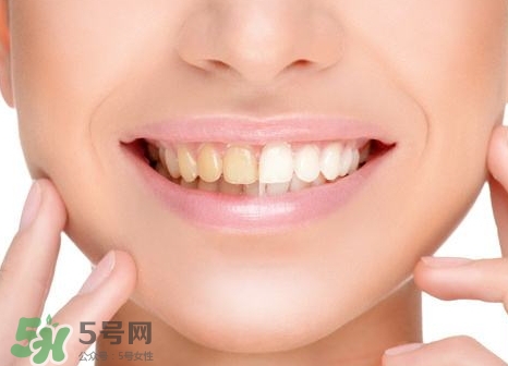 補牙洞用什么材料最好?補牙洞用什么材料結實?