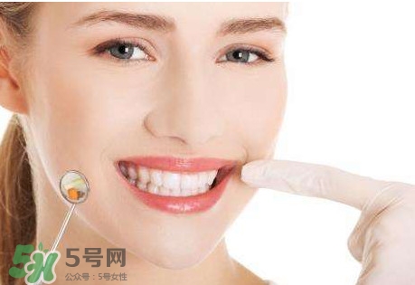如何去掉牙結(jié)石？牙結(jié)石怎么去除